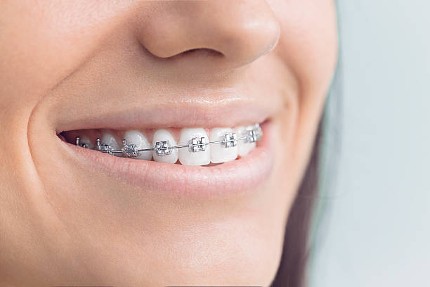 Best Dental Fillings (Composite and Amalgam)  in Talluh, LA